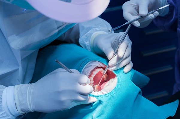 Oral surgery