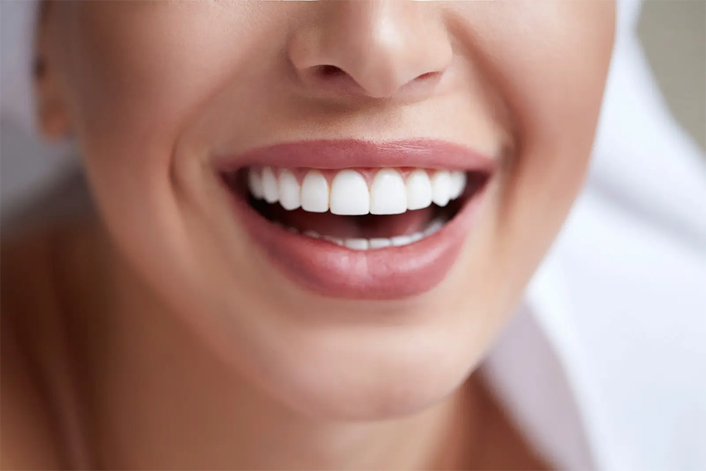 Cosmetic dentistry