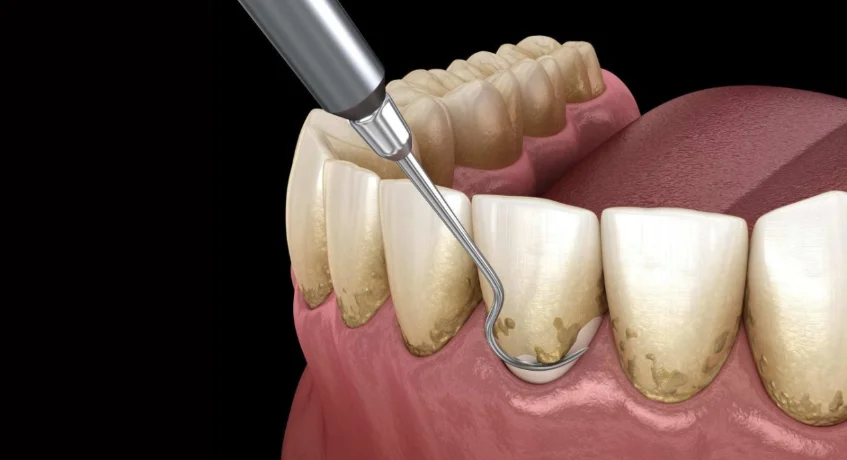 Restorative dentistry